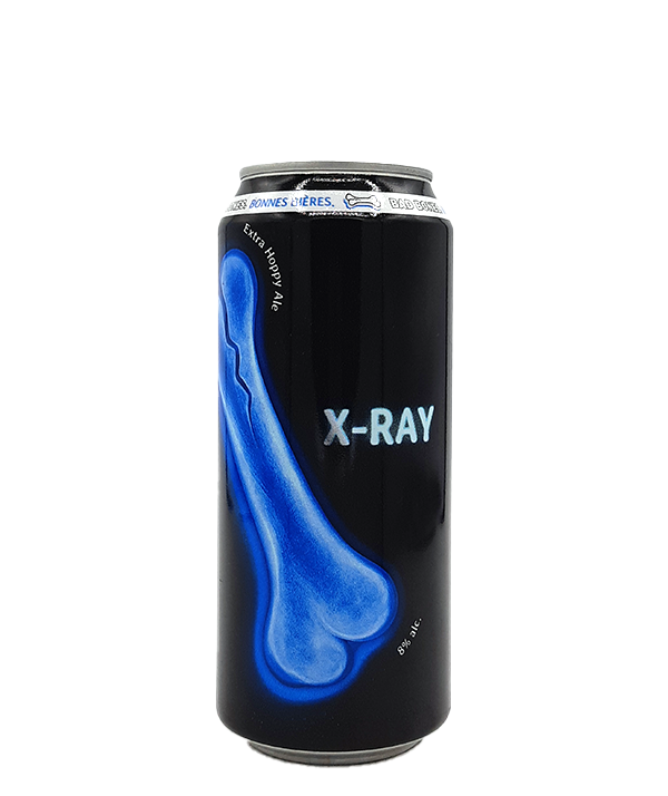 X-Ray